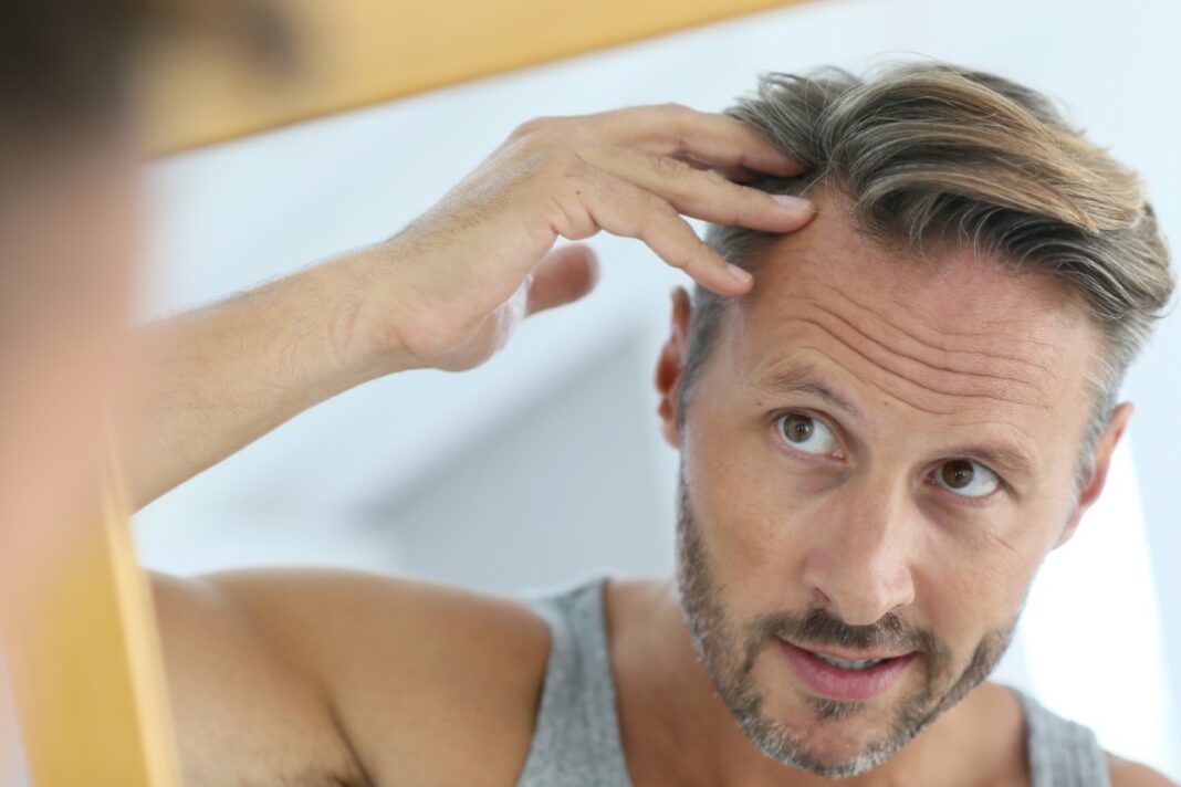 chute de cheveux homme hormones testostérone